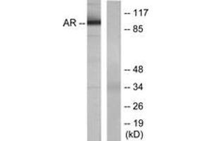 Western blot analysis of extracts from LOVO cells, using Androgen Receptor (Ab-650) Antibody. (Androgen Receptor Antikörper  (AA 621-670))