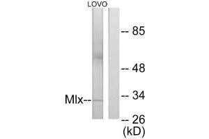 Western blot analysis of extracts from LOVO cells, using Mlx antibody. (MLX Antikörper)
