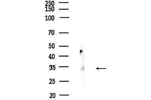 Western blot analysis of lysates from COLO205 cells, using ALX3 Antibody at 1/1000 dilution.