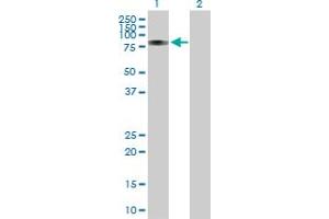 Western Blotting (WB) image for anti-Runt-Related Transcription Factor 1, Translocated To, 1 (Cyclin D-Related) (RUNX1T1) (AA 1-577) antibody (ABIN514061)