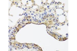 Immunohistochemistry of paraffin-embedded Mouse lung using TOMM34 Polyclonal Antibody at dilution of 1:100 (40x lens). (TOMM34 Antikörper)