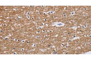 Immunohistochemistry of paraffin-embedded Human brain tissue using NCR2 Polyclonal Antibody at dilution 1:60 (NKp44/NCR2 Antikörper)