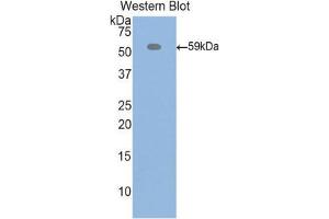 Western Blotting (WB) image for anti-Inter alpha Globulin Inhibitor H4 (ITIH4) (AA 478-722) antibody (ABIN1859513) (ITIH4 Antikörper  (AA 478-722))