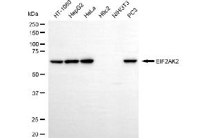 Western blotting analysis using EIF2AK2 antibody (ABIN7798508).