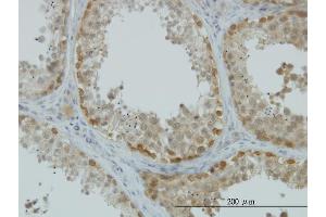 Immunoperoxidase of monoclonal antibody to ASNA1 on formalin-fixed paraffin-embedded human testis.