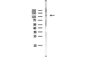 Western blot analysis of lysates from PC12 cells(LPS 4h treatment), using PPP6R2 Antibody at 1/1000 dilution.