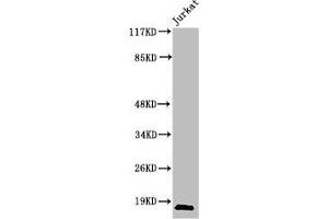 Western Blot analysis of Jurkat cells using Cleaved-Caspase-2 p18 (G170) Polyclonal Antibody (Caspase 2 Antikörper  (Cleaved-Gly170))