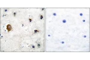 Immunohistochemistry analysis of paraffin-embedded human brain tissue, using Connexin 43 Antibody. (Connexin 43/GJA1 Antikörper  (AA 333-382))