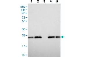 Western blot analysis of Lane 1: RT-4, Lane 2: U-251 MG, Lane 3: Human Plasma, Lane 4: Liver, Lane 5: Tonsil with C9orf142 polyclonal antibody  at 1:250-1:500 dilution.