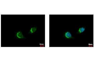 ICC/IF Image ETEA antibody [C3], C-term detects FAF2 protein at endoplasmic reticulum by immunofluorescent analysis.