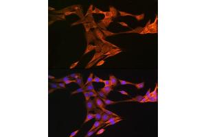Immunofluorescence analysis of NIH-3T3 cells using SQLE Rabbit pAb (ABIN1513563, ABIN5664074, ABIN5664075, ABIN5664076 and ABIN6219540) at dilution of 1:100 (40x lens).