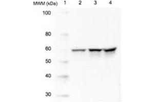 Western blot analysis of Src using 20 μg of whole cell lysate (Lane 2=HeLa, Lane 3=3T3, Lane 4=PC12) probed with with Src, mAb (5A18) at 1 μg/mL. (CSK Antikörper)