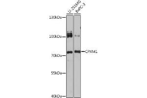 Western blot analysis of extracts of various cell lines, using CPXM1 antibody (ABIN7266082) at 1:1000 dilution. (CPXM1 Antikörper)