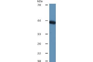 Western Blotting (WB) image for Haptoglobin (HP) ELISA Kit (ABIN6574216)