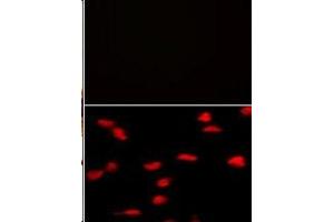 (TOP)Negative control of hela cells without PE-conjugated goat anti-mouse lgG (whole molecule). (SETD8 Antikörper  (N-Term))