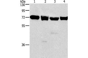 Western Blot analysis of 231, 293T, Raji and hela cell using IL2RB Polyclonal Antibody at dilution of 1:325 (IL2 Receptor beta Antikörper)