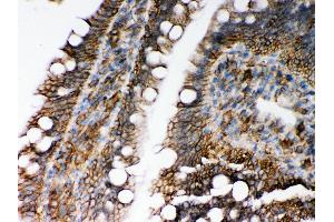 Anti- HLA-C Picoband antibody,IHC(P) IHC(P): Rat Intestine Tissue (HLA-C Antikörper  (C-Term))