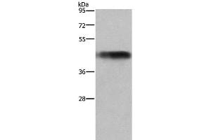 Western Blot analysis of Human fetal liver tissue using GALT Polyclonal Antibody at dilution of 1:300 (GALT Antikörper)