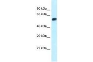Image no. 1 for anti-Endonuclease/exonuclease/phosphatase Family Domain Containing 1 (EEPD1) (N-Term) antibody (ABIN6747925) (EEPD1 Antikörper  (N-Term))