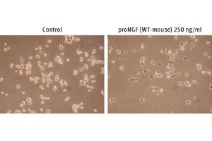 Nerve Growth Factor (NGF) protein