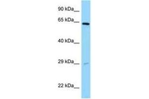 Image no. 1 for anti-Sorting Nexin 11 (SNX11) (AA 90-139) antibody (ABIN6748157) (SNX11 Antikörper  (AA 90-139))