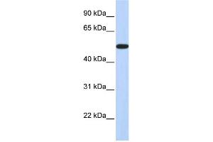 WB Suggested Anti-HOXA3 Antibody Titration:  0. (HOXA3 Antikörper  (Middle Region))
