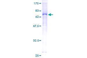 ENPP5 Protein (AA 24-477) (GST tag)