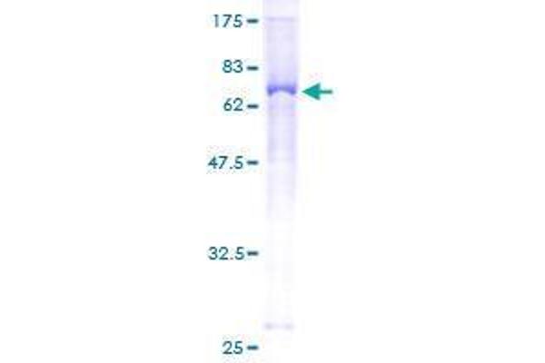 ENPP5 Protein (AA 24-477) (GST tag)