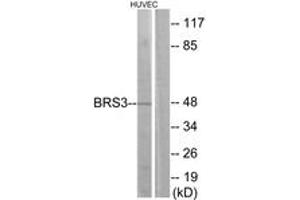 Western Blotting (WB) image for anti-Bombesin-Like Receptor 3 (BRS3) (AA 161-210) antibody (ABIN2890810) (BRS3 Antikörper  (AA 161-210))