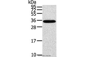 Western blot analysis of Mouse brain tissue, using KCNMB3 Polyclonal Antibody at dilution of 1:300 (KCNMB3 Antikörper)