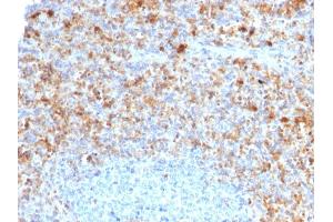 Formalin-fixed, paraffin-embedded human Spleen stained with CD40L-Monospecific Mouse Monoclonal Antibody (CD40LG/2761) (CD40 Ligand Antikörper  (AA 108-261))