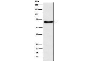 Western blot analysis of CYP24A1 expression in Human fetal liver lysate.