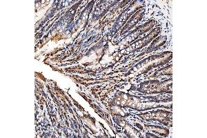 IHC analysis of SNRPA1 using anti-SNRPA1 antibody (ABIN7599131). (SNRPA1 Antikörper  (AA 1-233))