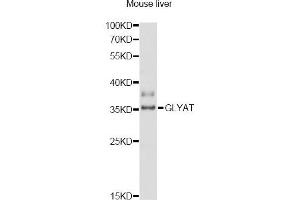 Western blot analysis of extracts of mouse liver, using GLYAT antibody (ABIN6293111) at 1:3000 dilution.