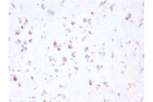 Formalin-fixed, paraffin-embedded human Cerebellum stained with FCGRT Mouse Monoclonal Antibody (FCGRT/2932). (FcRn Antikörper  (AA 24-215))