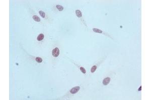 Immunocytochemistry analysis of ABIN7127301 diluted at 1:100 and staining in Hela cells performed on a Leica BondTM system. (Rekombinanter HIST1H3A Antikörper  (H3K36me))