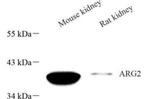 Western blot analysis of Arg2 (ABIN7073115),at dilution of 1: 600 (ARG2 Antikörper)