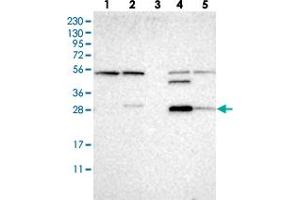 Western blot analysis of Lane 1: RT-4, Lane 2: U-251 MG, Lane 3: Human Plasma, Lane 4: Liver, Lane 5: Tonsil with CA13 polyclonal antibody  at 1:250-1:500 dilution. (CA13 Antikörper)
