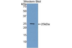 Western Blotting (WB) image for anti-C-Reactive Protein (CRP) (AA 20-222) antibody (Biotin) (ABIN1858502)