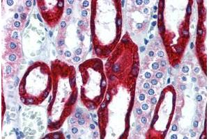 Human Kidney (formalin-fixed, paraffin-embedded) stained with KRT19 antibody ABIN292298 at 10 ug/ml followed by biotinylated anti-mouse IgG secondary antibody ABIN481714, alkaline phosphatase-streptavidin and chromogen. (Cytokeratin 19 Antikörper)