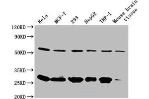 Western Blot Positive WB detected in: Mouse spleen tissue All lanes: RPL19 antibody at 2 μg/mL Secondary Goat polyclonal to rabbit IgG at 1/50000 dilution Predicted band size: 24 kDa Observed band size: 24 kDa (RPL19 Antikörper  (AA 79-196))