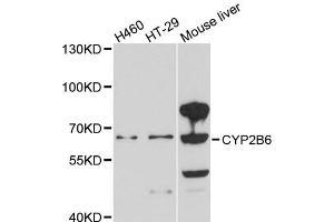 Western blot analysis of extracts of various cell lines, using CYP2B6 antibody (ABIN5997556) at 1/1000 dilution. (CYP2B6 Antikörper)