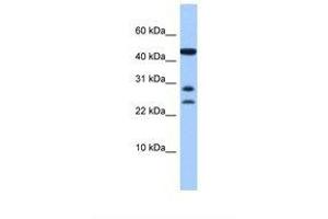 Image no. 1 for anti-Chromosome 20 Open Reading Frame 141 (C20orf141) (AA 91-140) antibody (ABIN6739362) (C20orf141 Antikörper  (AA 91-140))