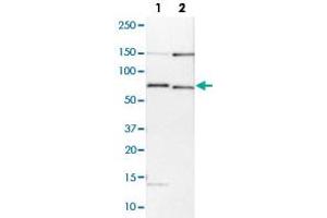 Western blot analysis of Lane 1: NIH-3T3 cell lysate (Mouse embryonic fibroblast cells); Lane 2: NBT-II cell lysate (Rat Wistar bladder tumour cells) with BIRC3 polyclonal antibody  at 1:100-1:250 dilution. (BIRC3 Antikörper)