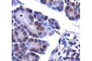 Staining of LPIN1 on mouse pancreas using LPIN1 polyclonal antibody . (Lipin 1 Antikörper  (AA 300-400))