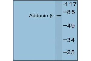 Western blot analysis of Beta-Adducin Antibody in extracts from 293 cells. (ADD2 Antikörper)