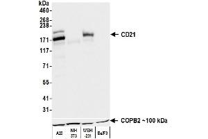 Western Blotting (WB) image for anti-Complement Component (3d/Epstein Barr Virus) Receptor 2 (CR2) (C-Term) antibody (ABIN7795815) (Rekombinanter CD21 Antikörper  (C-Term))