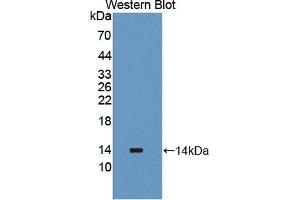 Detection of Recombinant PLOD2, Human using Polyclonal Antibody to Procollagen Lysine-2-Oxoglutarate-5-Dioxygenase 2 (PLOD2)