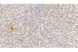 Detection of VF in Human Liver Tissue using Monoclonal Antibody to Visfatin (VF)