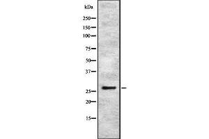 Western blot analysis IBP4 using K562 whole cell lysates (IGFBP4 Antikörper  (Internal Region))